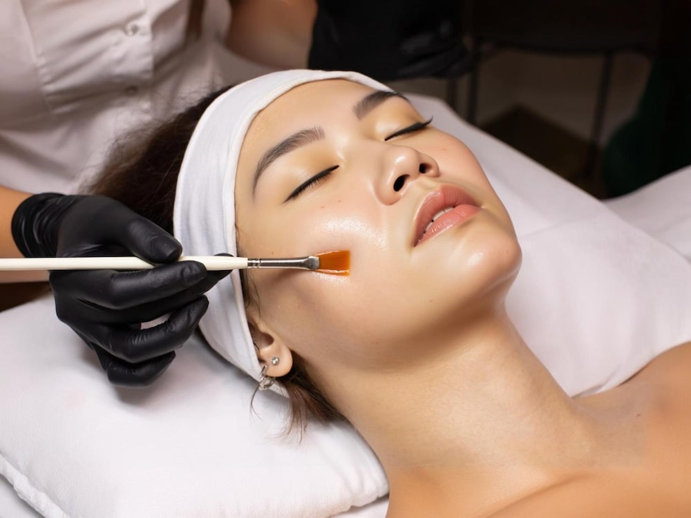 chemical peel treatment for melasma in malaysia