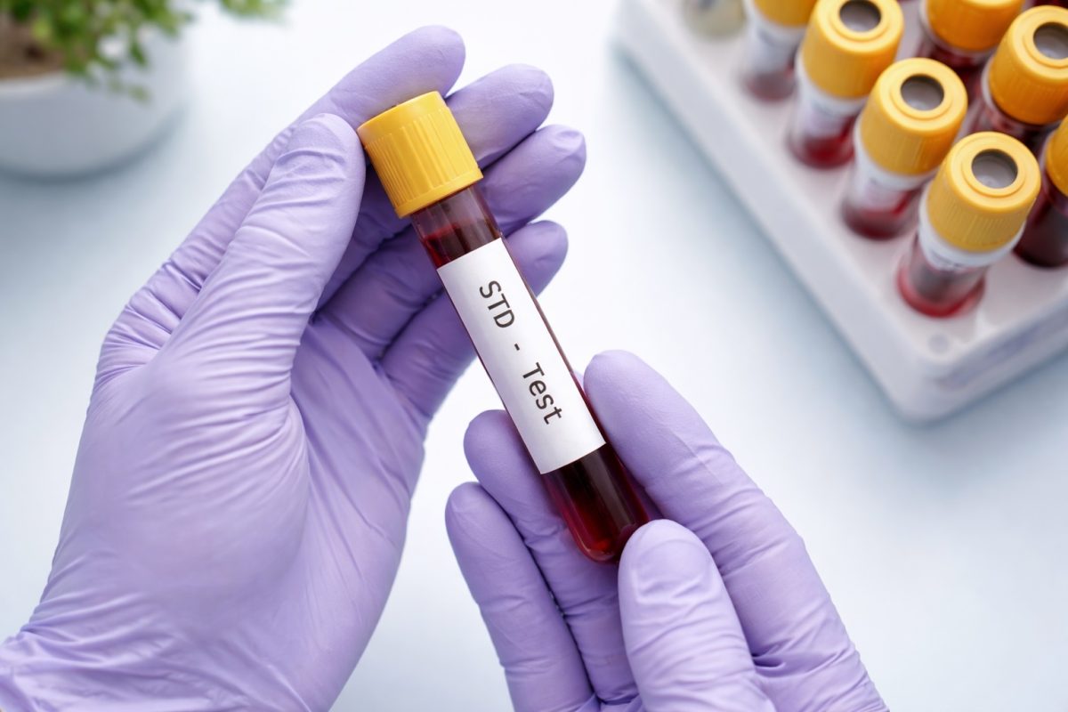 Gloved hands holding a blood sample tube for STD screening, representing safe, confidential laboratory testing.