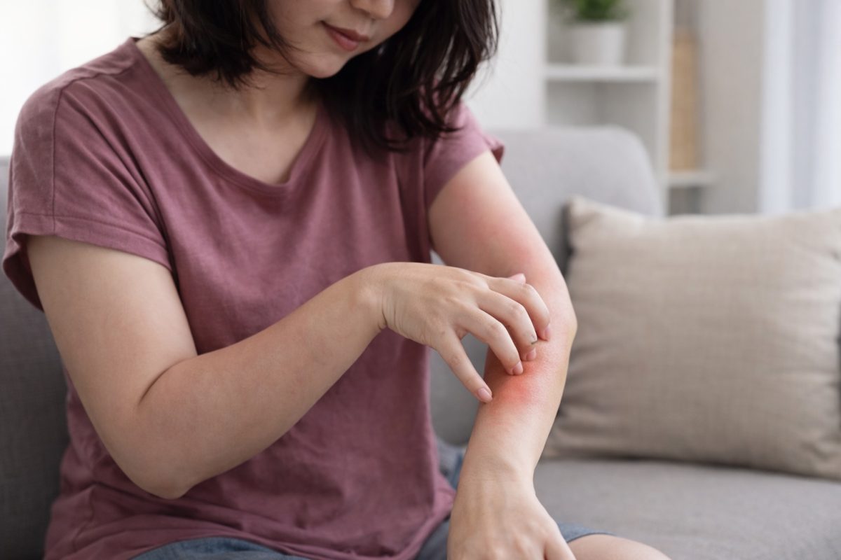 Woman scratching skin rash linked to STI symptoms, showing how infections may present before becoming diagnosed STDs.