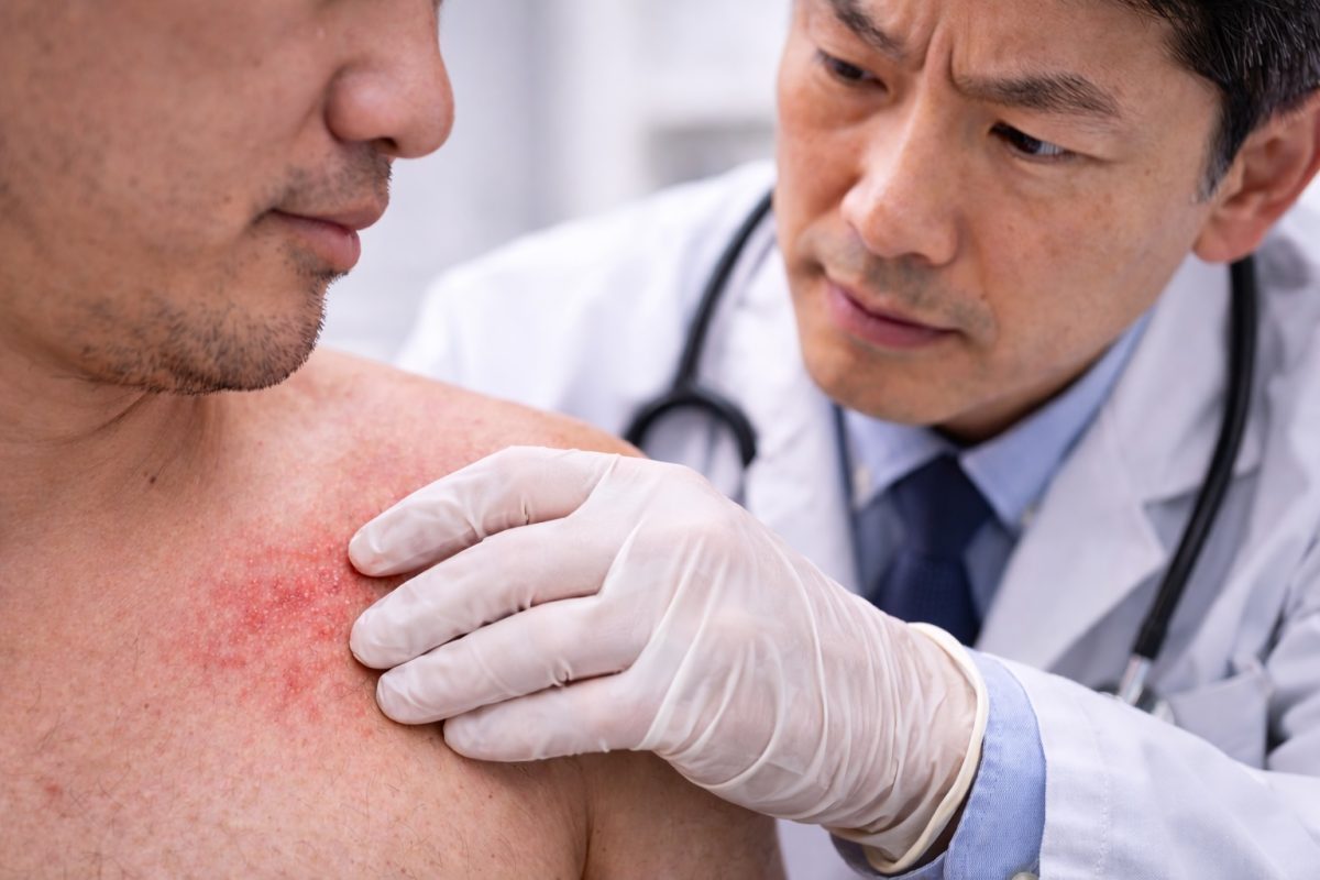 Seorang doktor memeriksa ruam pada badan pesakit