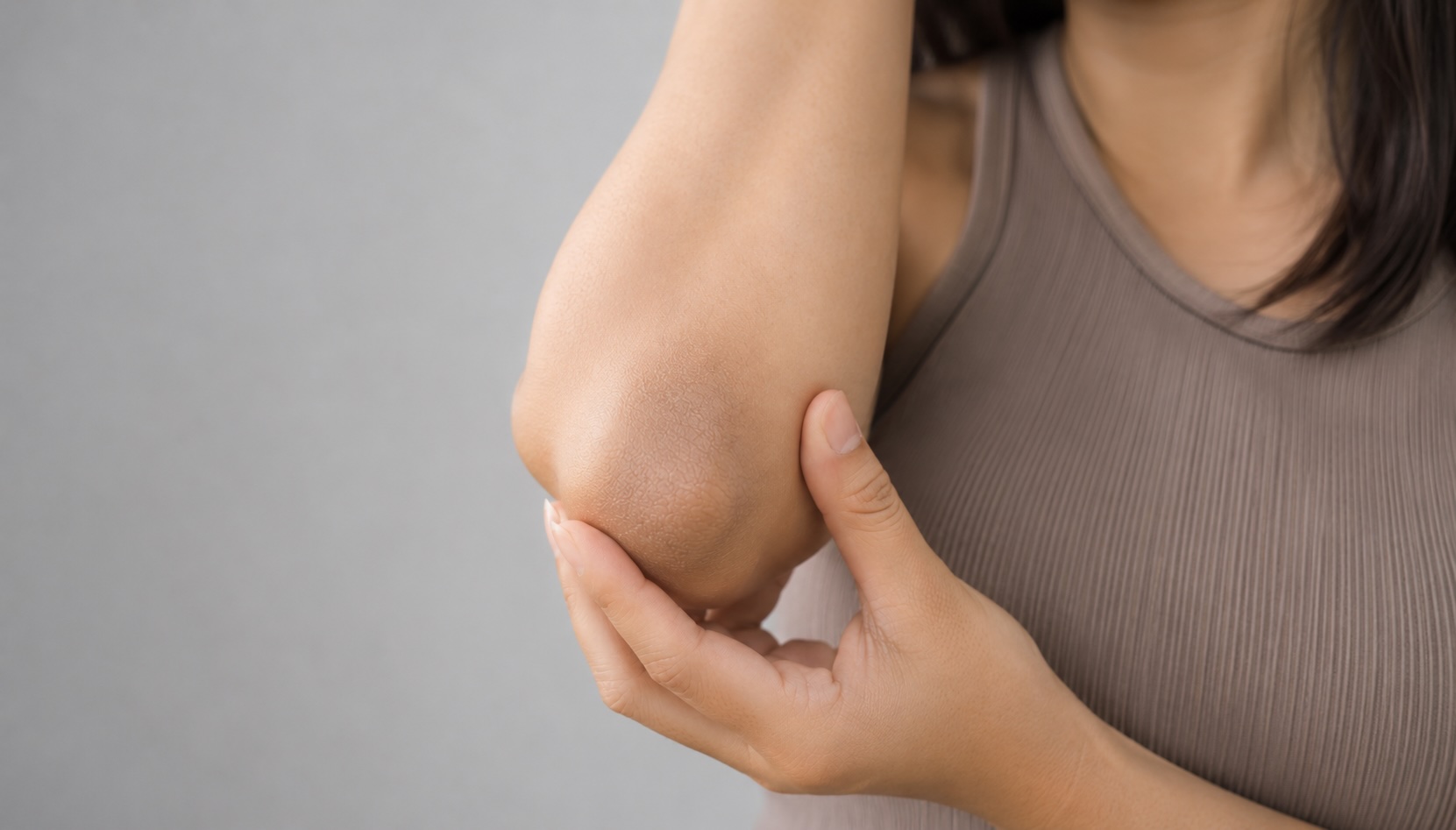 Close-up of dry, darkened elbow showing rough texture and ashy skin caused by dryness or friction